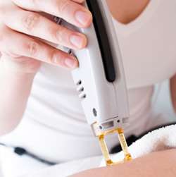 All You Need to Know About Laser Hair Removal Arabia Weddings